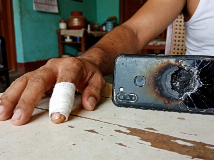 Aligarh consumer panel orders iPhone refund after pocket explosion Nerds Magazine