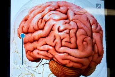 human brain