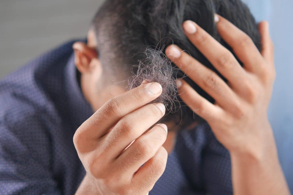 Hair loss can be emotionally devastating