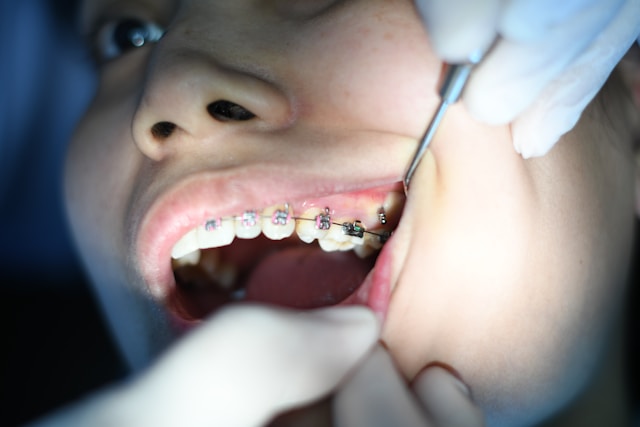 dentist checking a patient's braces.