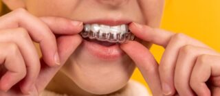 girl inserting clear teeth straightening brace into her mouth.