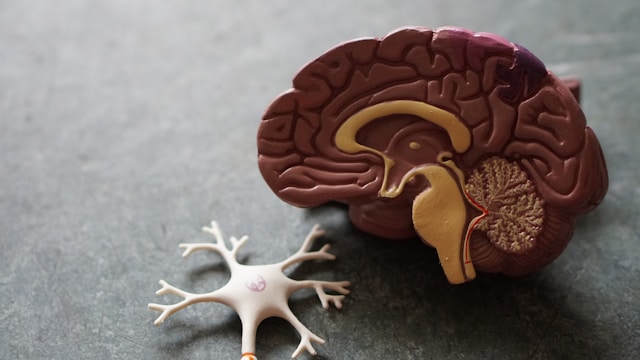 model of brain and nerve endings.